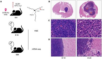 Expression of intra-tumoral necrosis-associated cytokine pattern correlated with prognosis and immune status in glioma